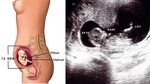 Entwicklung Embryo/Fötus: Größen-Tabelle & Bilder - Hallo El